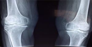 Read more about the article Pros and Cons of X-Rays
