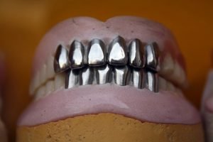 Read more about the article Pros and cons of dentures