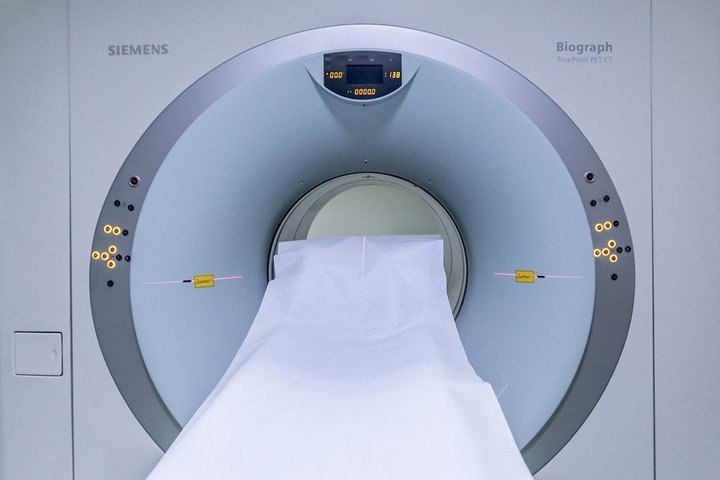You are currently viewing Pros and cons of MRI
