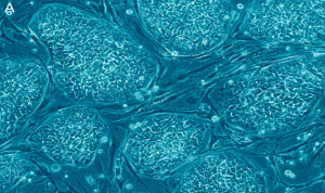 Read more about the article Pros and Cons of embryonic stem cells